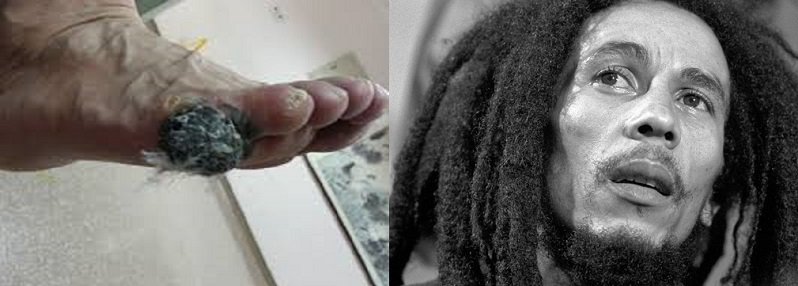Bob Marley was born whole and died whole
