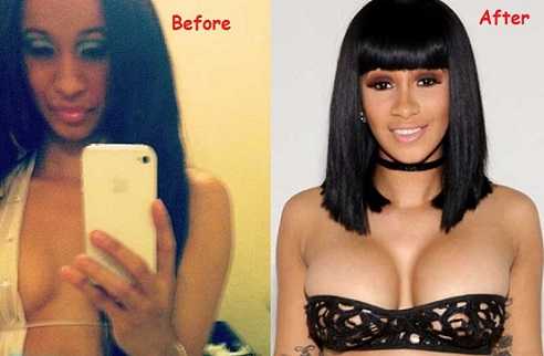 Cardi B before and after plastic surgery