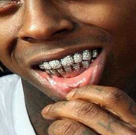 Lil Wayne has permanent grills for his tooth