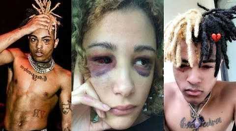 XXXtentacion beat up his wife so bad she had a miscarriage