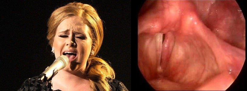 Adele quit smoking after voice injury